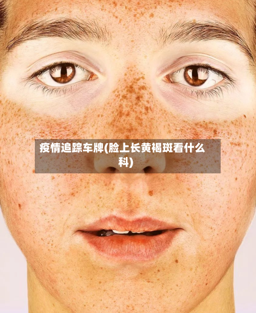 疫情追踪车牌(脸上长黄褐斑看什么科)-第1张图片