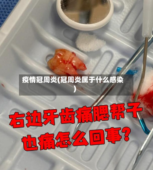 疫情冠周炎(冠周炎属于什么感染)